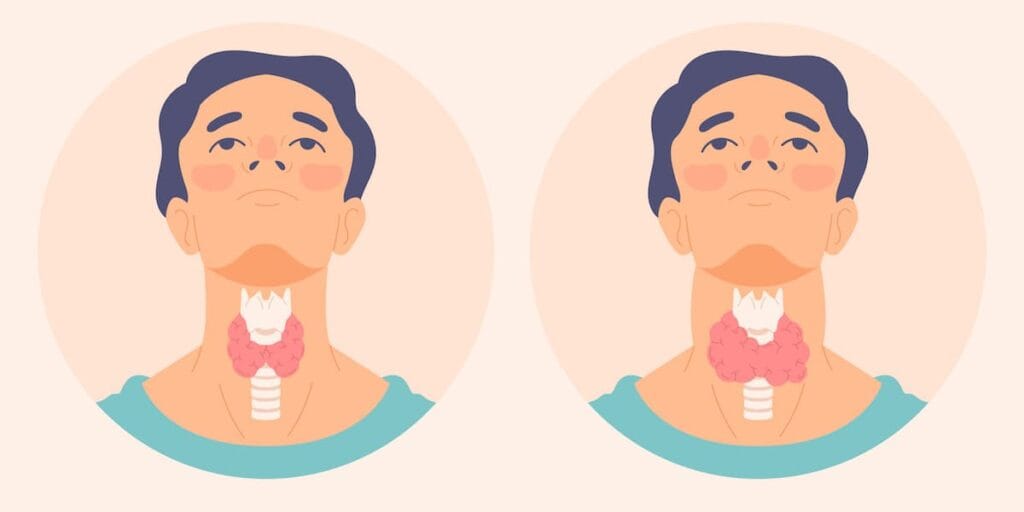 čvorići na štitnoj žlezdi