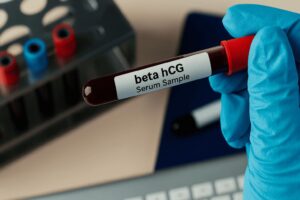 beta hCG
